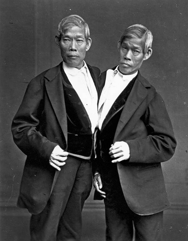 chang-eng-bunker-twins
